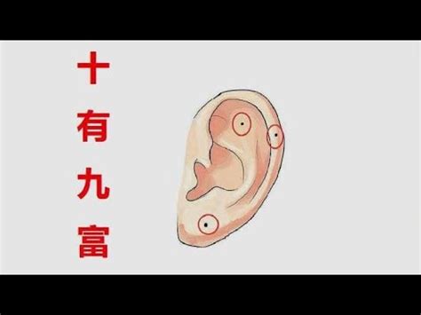 耳朵黑痣|耳朵痣相：你的潛在好運氣